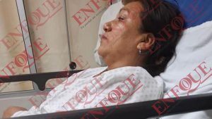 Detienen a mujer que tiro aceite quemado a trabajadora de una fonda